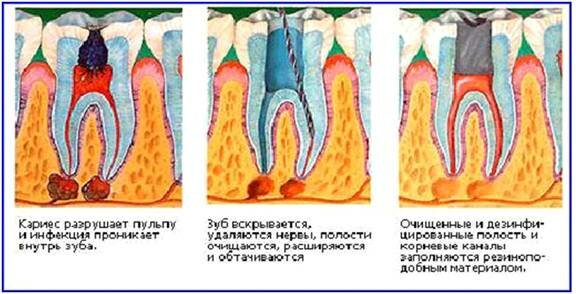 лечение зубов киев цены